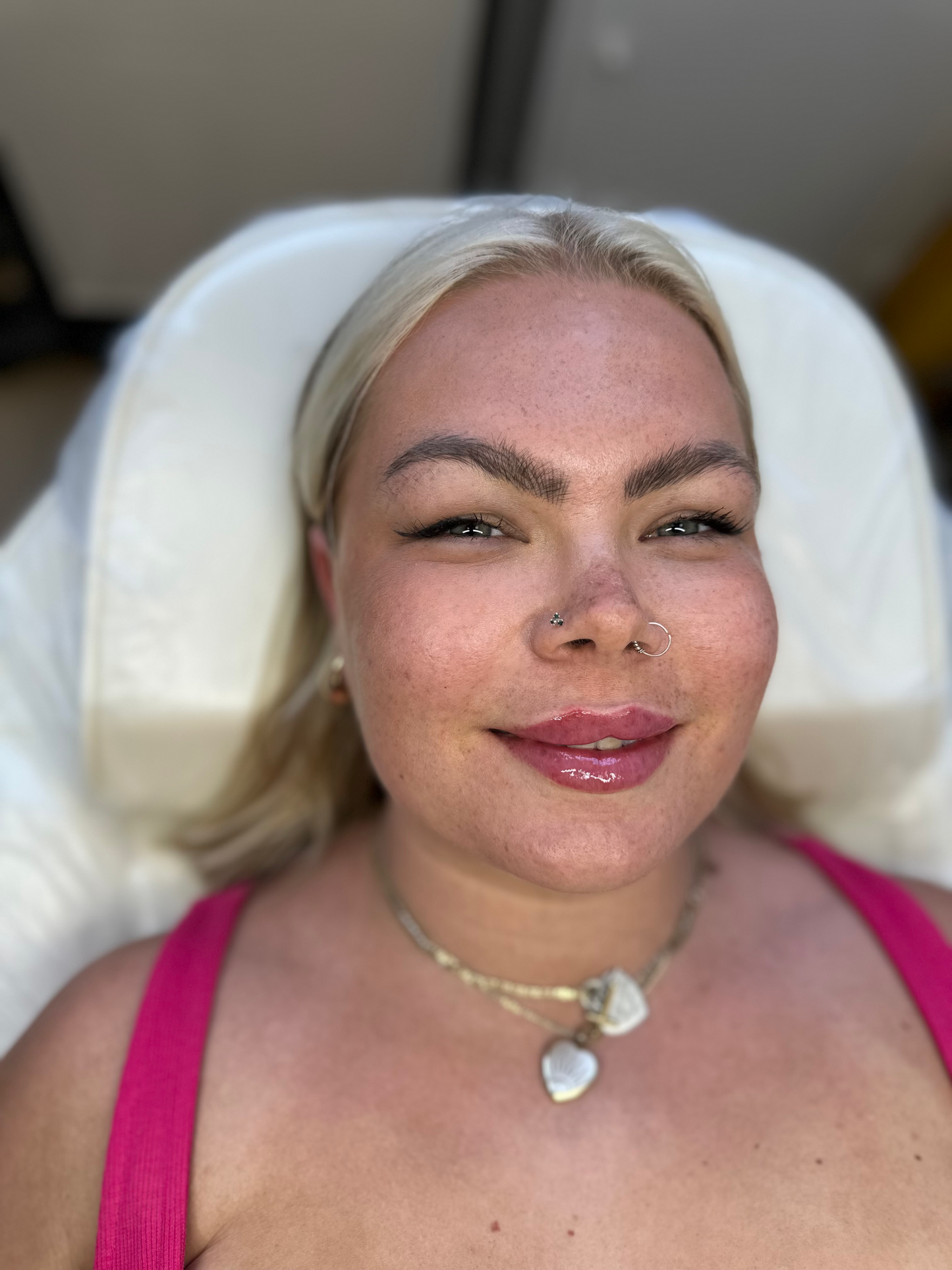 Lip Filler For M Shape Lips