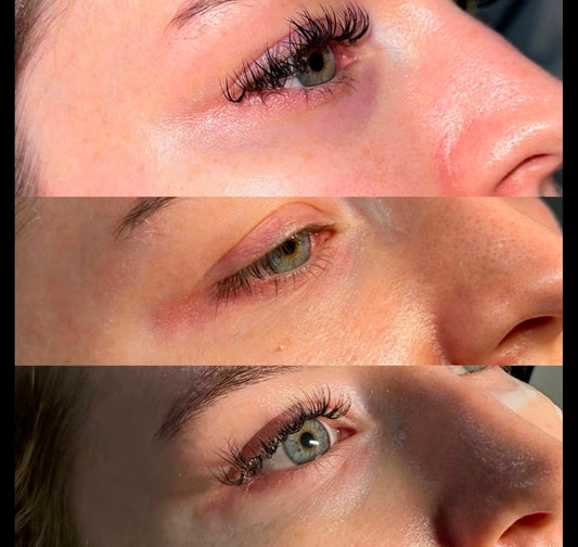 Polynucleotides For Under Eye Rejuvenation