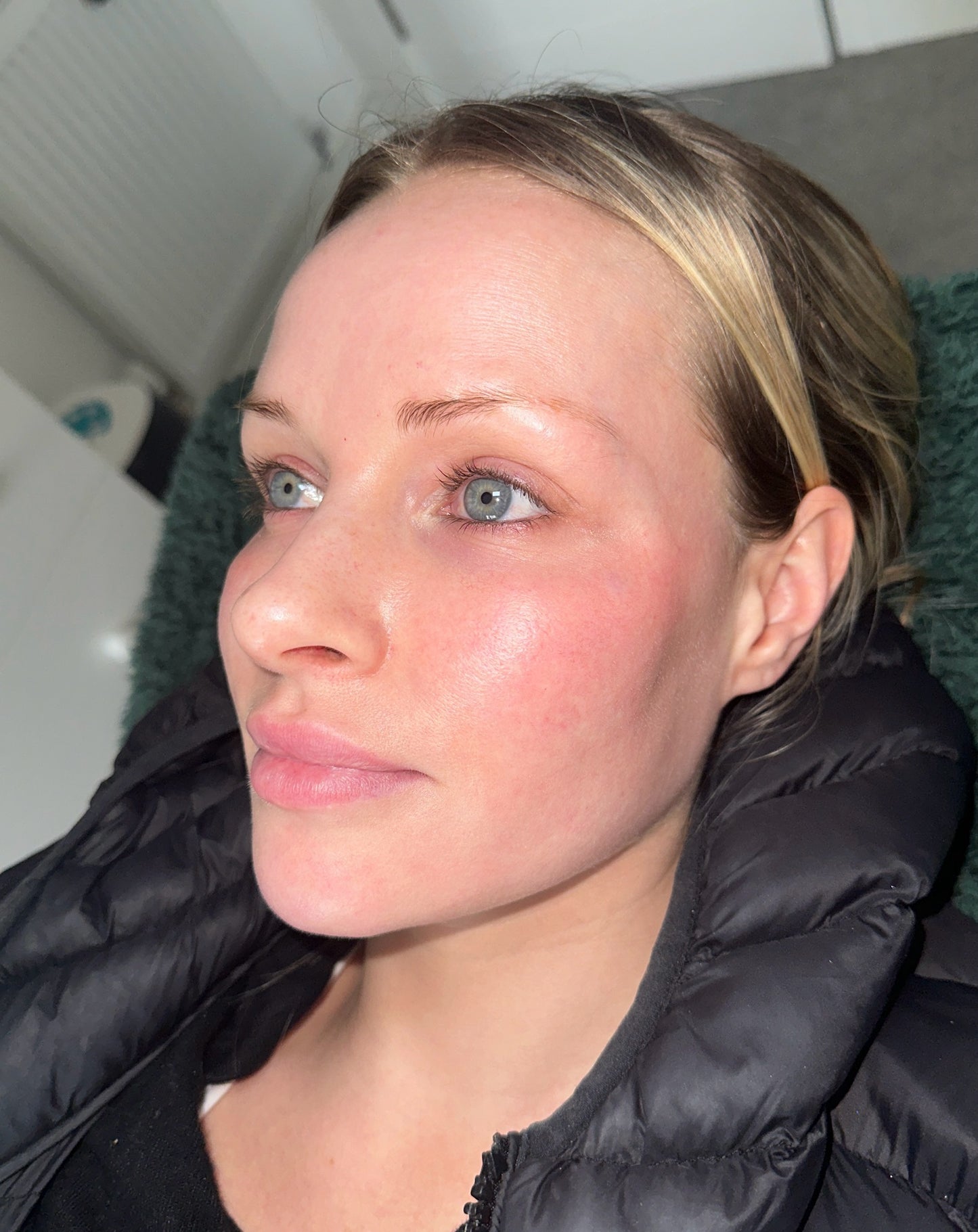 Polynucleotides For Full Face