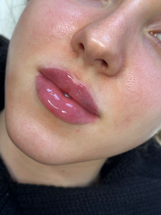 Lip Flip & 0.5 Lip Filler